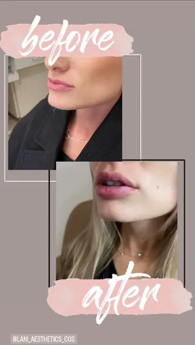 Lani Aesthetics Picture 2