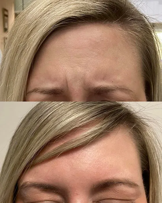 Lani Aesthetics Picture 3