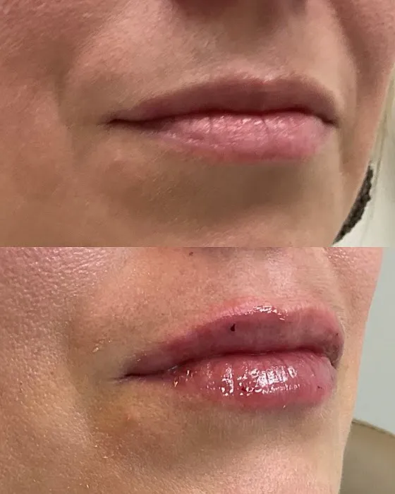 Lani Aesthetics Picture 4