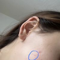 Beauty for Ashes Aesthetics ico