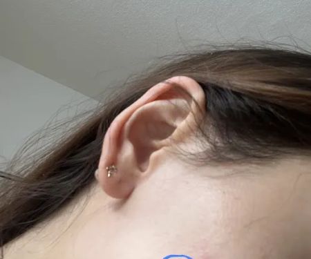 Beauty for Ashes Aesthetics