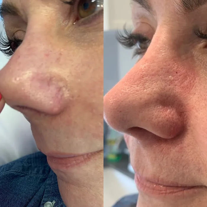 Linnea Skin Picture 8