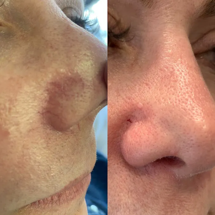 Linnea Skin Picture 7