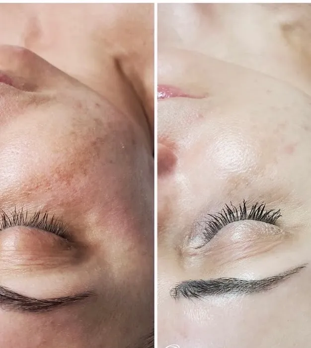 Linnea Skin Picture 3