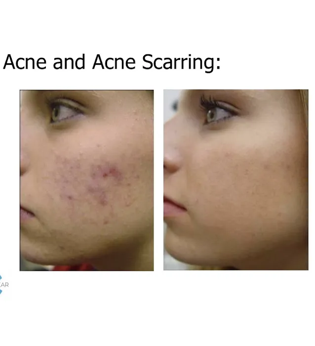 Linnea Skin Picture 6