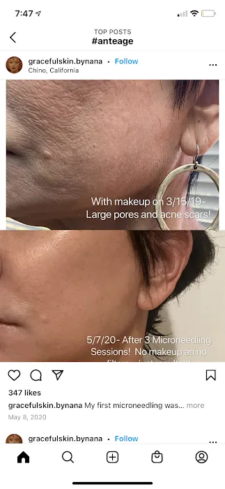 Linnea Skin Picture 9