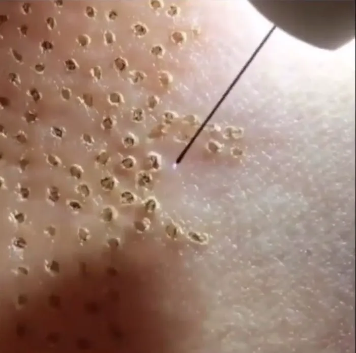 Foxy Aesthetics Picture 6