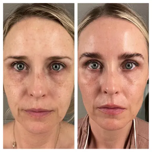 Foxy Aesthetics Picture 5