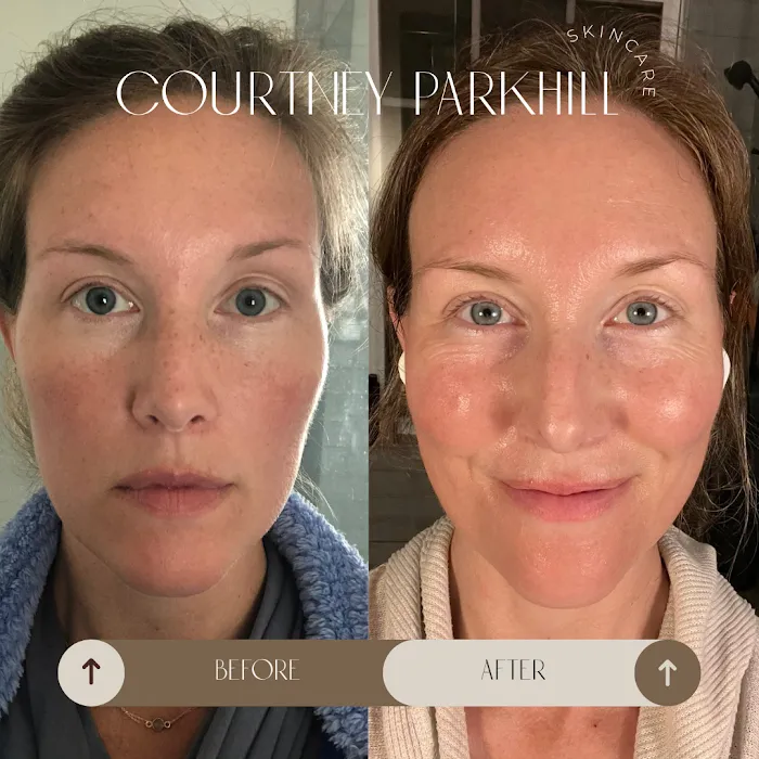 Alpenglow Skin Spa Picture 8