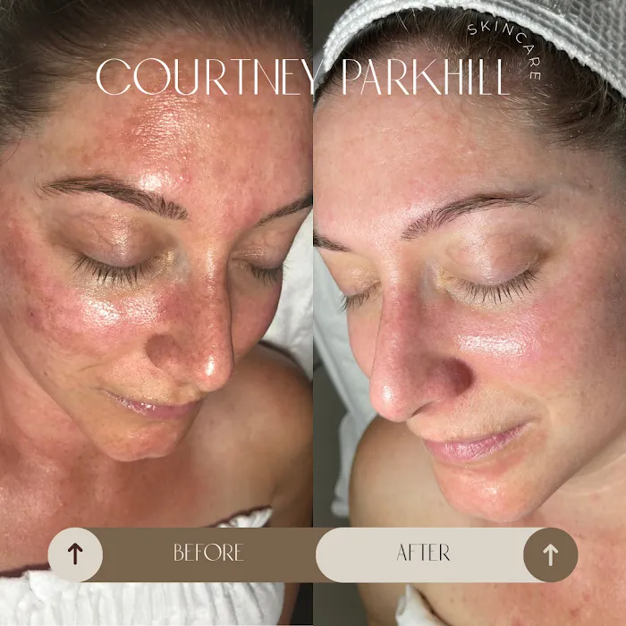 Alpenglow Skin Spa Picture 10