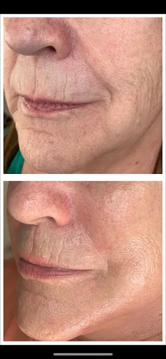 Rendition Esthetics Picture 4