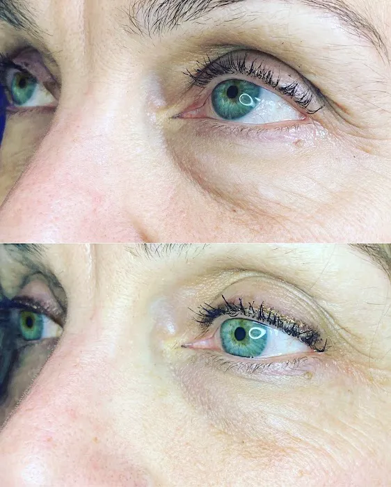 Rendition Esthetics Picture 5