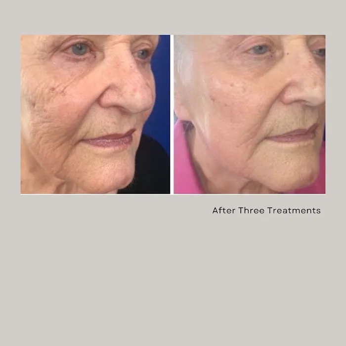 Rendition Esthetics Picture 6