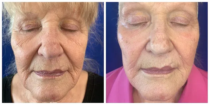 Rendition Esthetics Picture 8