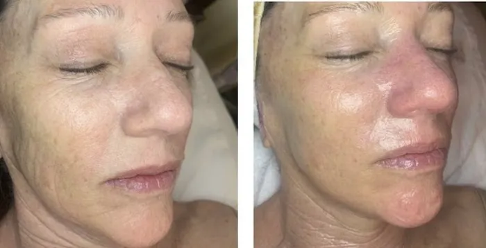 Rendition Esthetics Picture 10