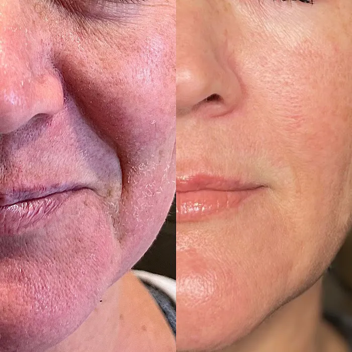 Juliette James, LE Picture 1