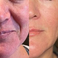 Juliette James, LE ico