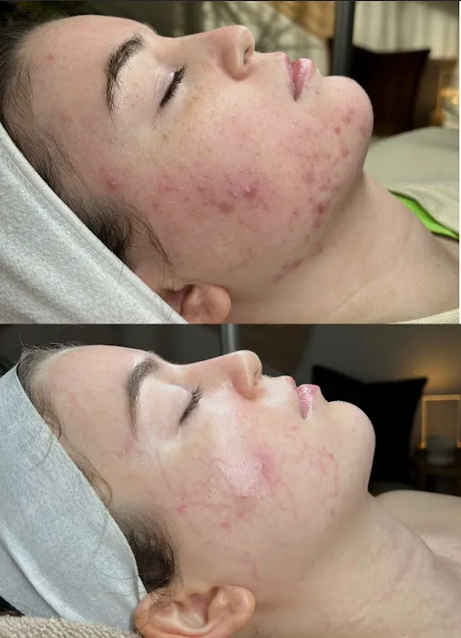 Akmē Aesthetics Picture 3