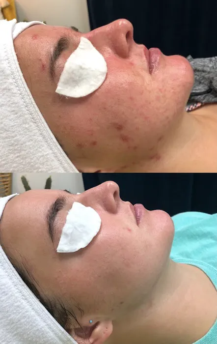 Akmē Aesthetics Picture 1