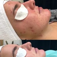 Akmē Aesthetics ico