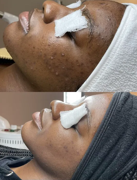 Akmē Aesthetics Picture 5