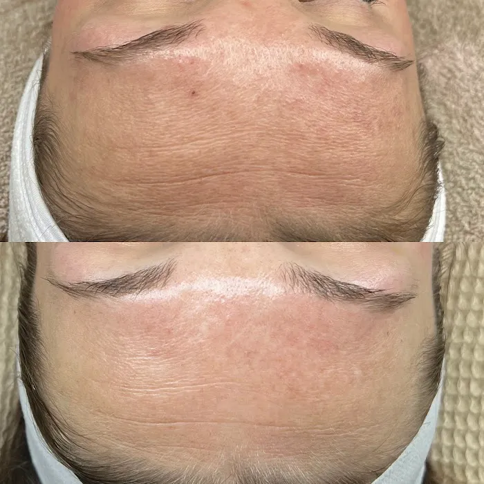 Akmē Aesthetics Picture 7