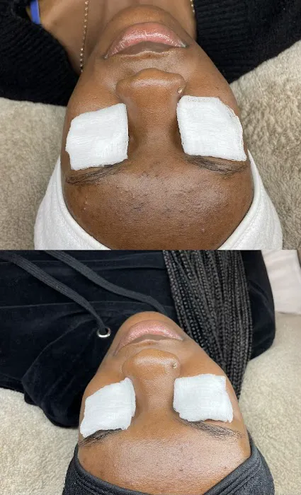 Akmē Aesthetics Picture 6