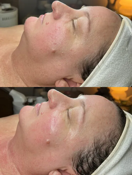 Akmē Aesthetics Picture 9