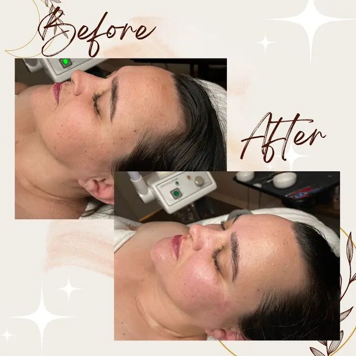 Wax and Wane Esthetics Picture 3