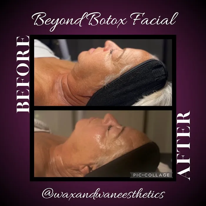 Wax and Wane Esthetics Picture 6