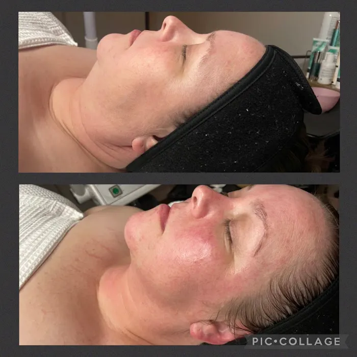 Wax and Wane Esthetics Picture 5