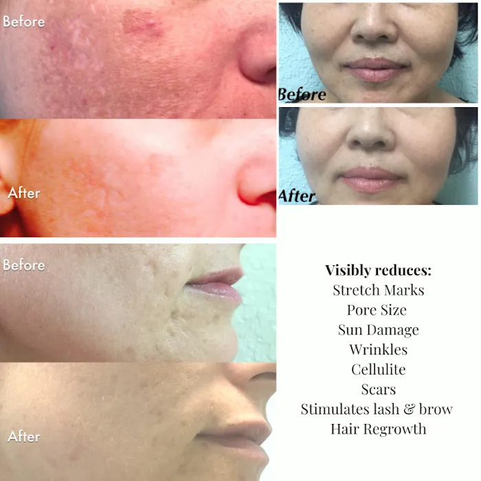 Elevated Z Aesthetics Picture 8