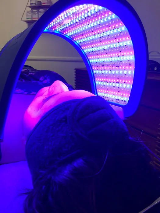 Sace Aesthetics Picture 2