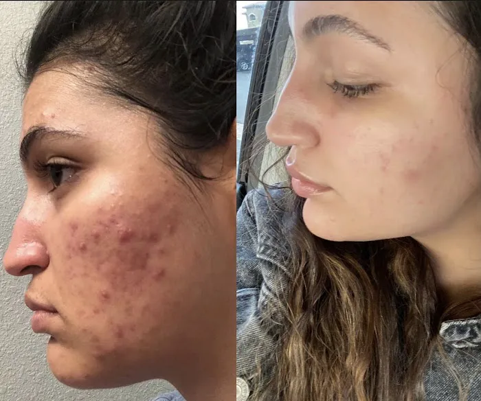 Sace Aesthetics Picture 5