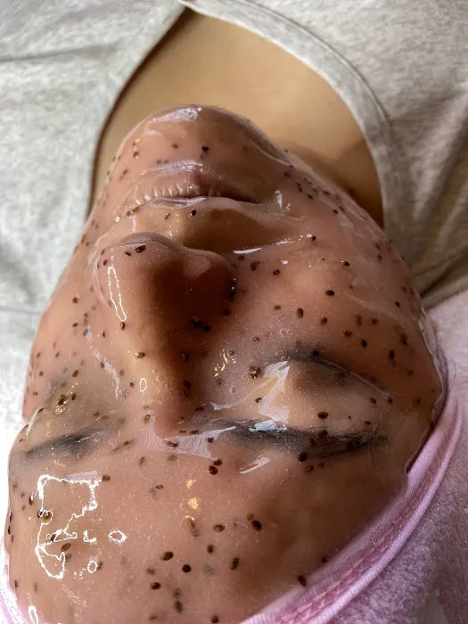 Sace Aesthetics Picture 1