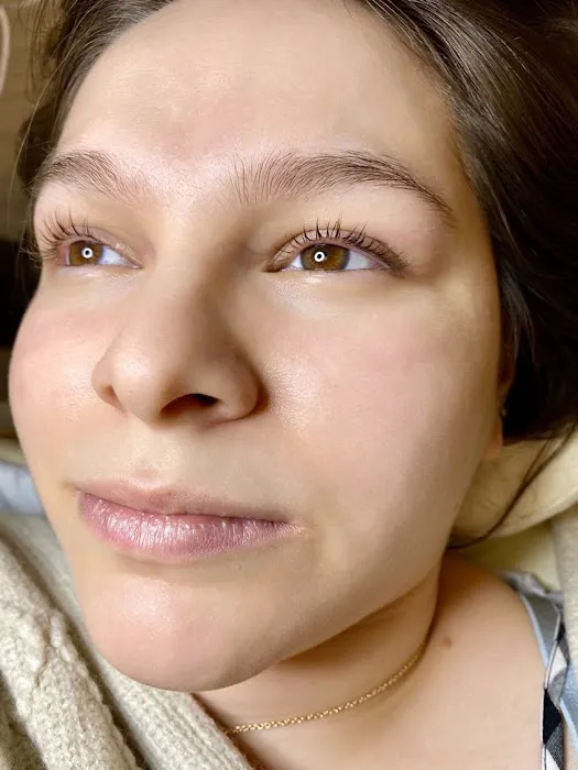 Sace Aesthetics Picture 6