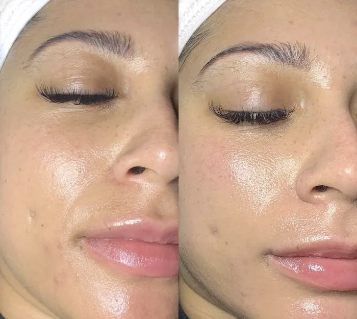 Anointed Skin Picture 2