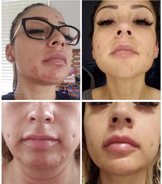 Anointed Skin Picture 8