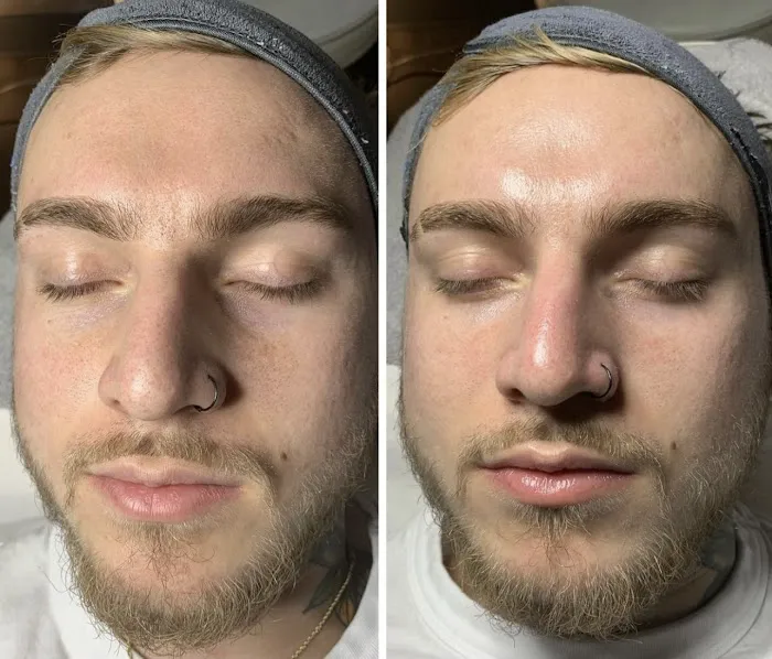 Anointed Skin Picture 7