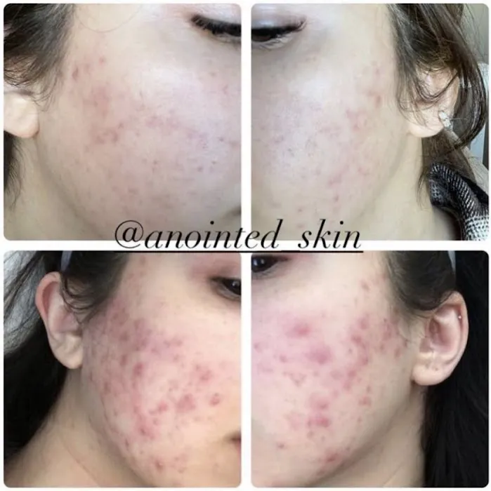 Anointed Skin Picture 4