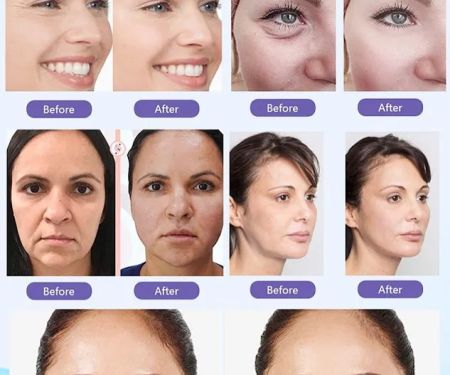 Hollywood Wellness Med Spa