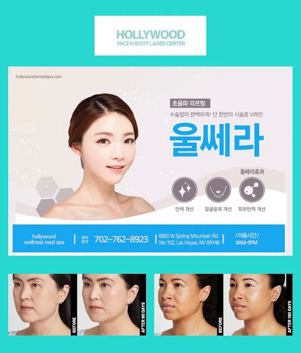 Hollywood Wellness Med Spa Picture 9