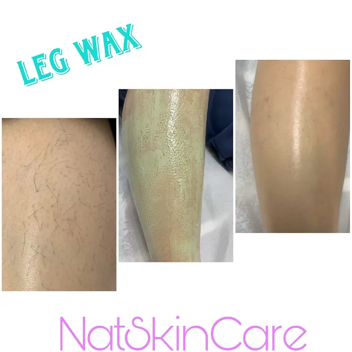 NatSkinCare Picture 1