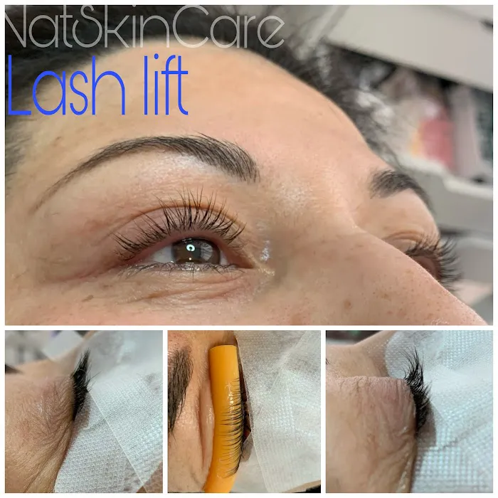 NatSkinCare Picture 5