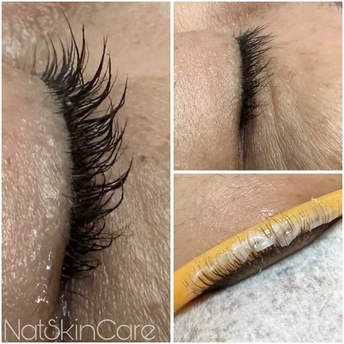 NatSkinCare Picture 6