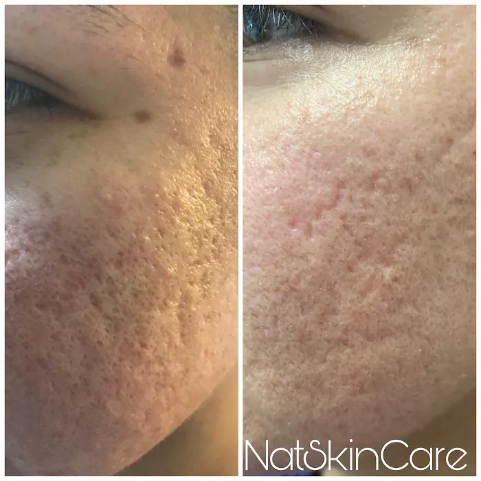 NatSkinCare Picture 8