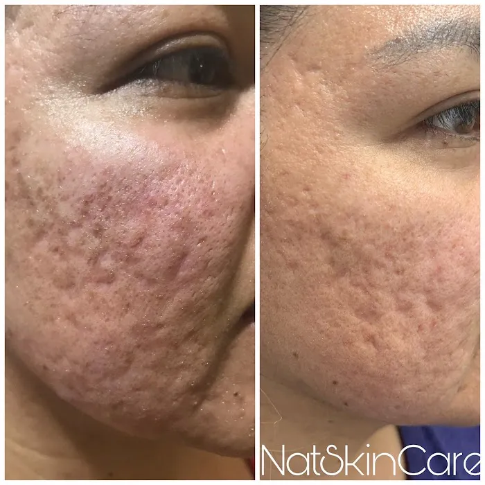 NatSkinCare Picture 7