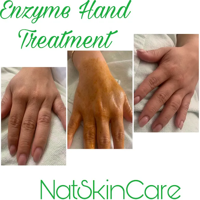 NatSkinCare Picture 9