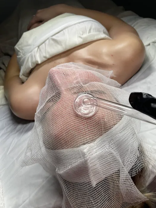 Superfly Esthetics Picture 8