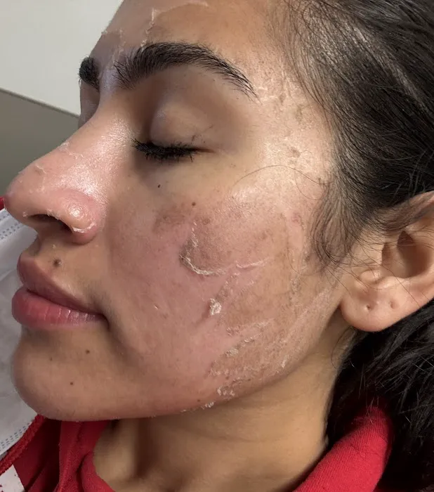 5 Years Younger Picture 5